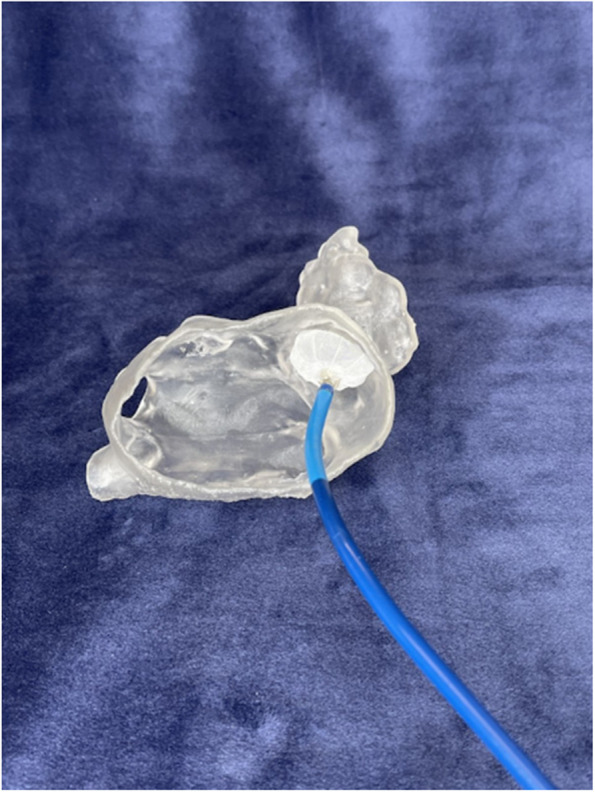 Stratifying complexity among the widespread use of 3D printing in United States health care facilities.