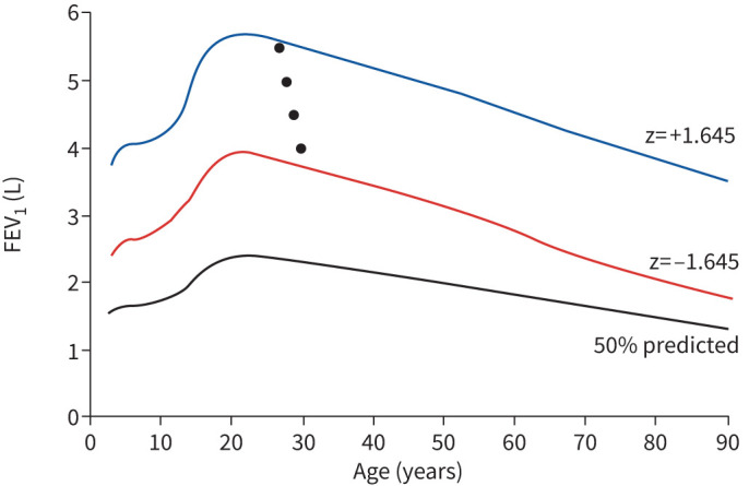 Integration of lung function data: turning snapshots into stories.
