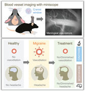 Harnessing Miniscope Imaging in Freely Moving Animals to Unveil Migraine Pathophysiology and Validate Novel Therapeutic Strategies.