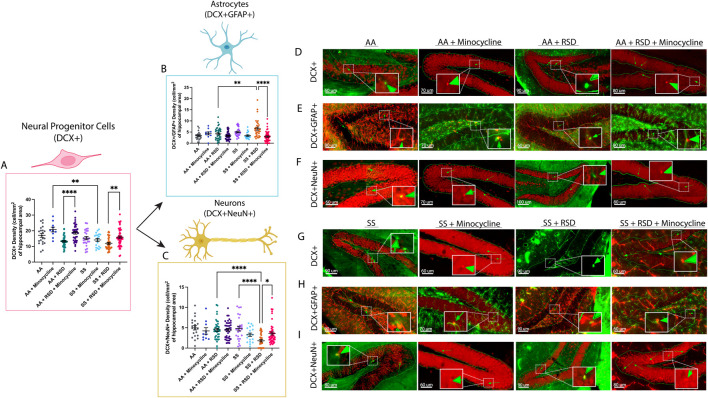 Neuroinflammation underlies the development of social stress induced cognitive deficit in male sickle cell mice.