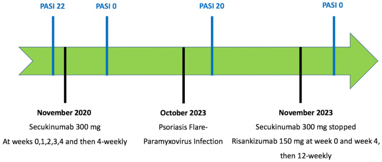 Psoriasis Flare Following Paramyxovirus Infection.
