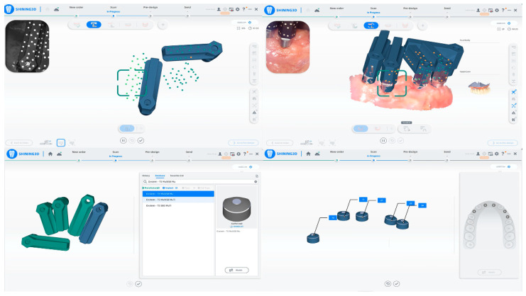An In Vivo Comparison of Trueness and Precision of Two Novel Methods for Improving Edentulous Full Arch Implant Scanning Accuracy: A Pilot Study.