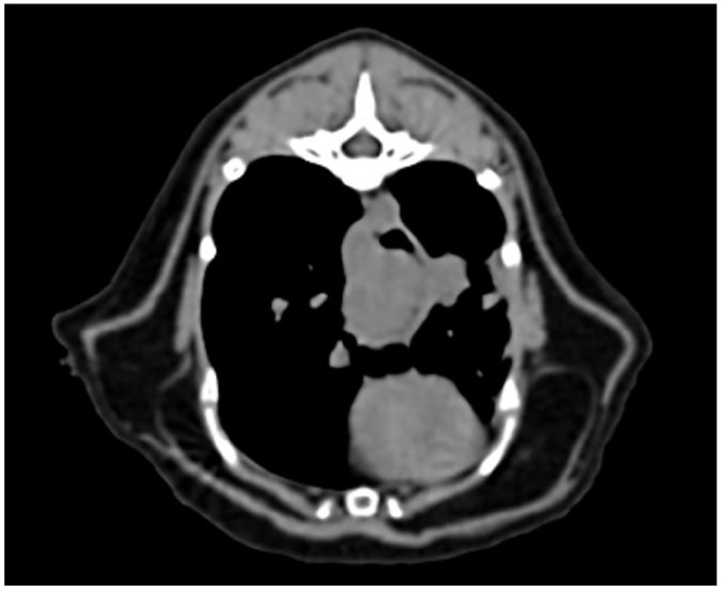 Transendoscopic laser ablation of an esophageal plasma cell tumor in a cat.