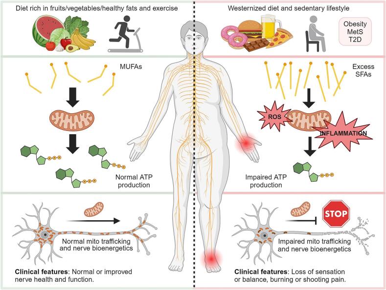 Neuropathy and the metabolic syndrome