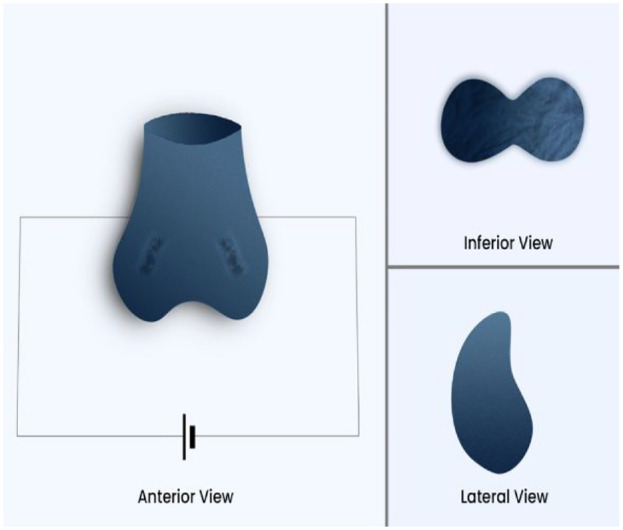Direct and Gradual Electrical Testicular Shocks Stimulate Spermatogenesis and Activate Sperms in Infertile Men: A Randomized Controlled Trial.