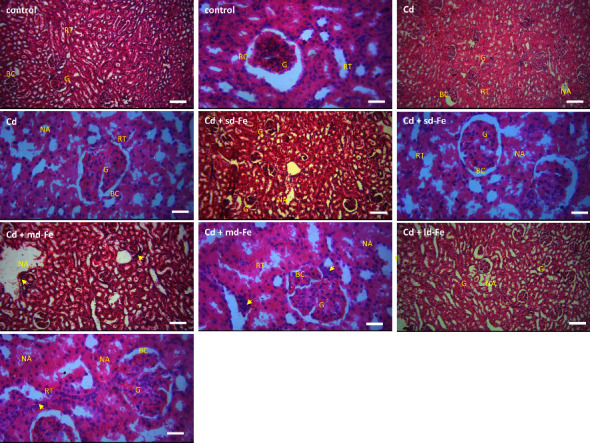 Iron Administration Partially Ameliorates Cadmium-Induced Oxidative Damage in the Liver and Kidney of Rats.