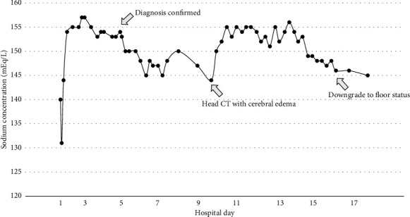 Osmotic Demyelination Syndrome in the Setting of Normonatremia: A Case Report and Review of the Literature.