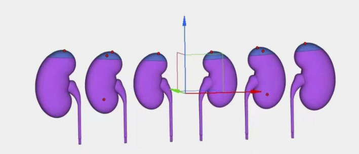 Optimization and application of renal depth measurement method in the cadmium-zinc-telluride‑based SPECT/CT renal dynamic imaging.