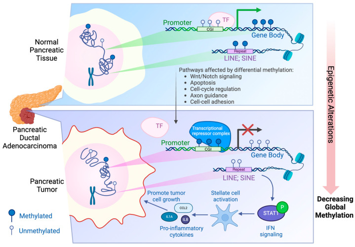 Epigenetic Landscape of DNA Methylation in Pancreatic Ductal Adenocarcinoma.