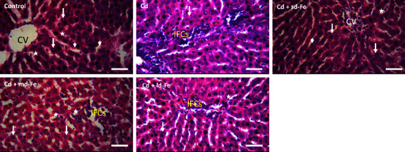 Iron Administration Partially Ameliorates Cadmium-Induced Oxidative Damage in the Liver and Kidney of Rats.