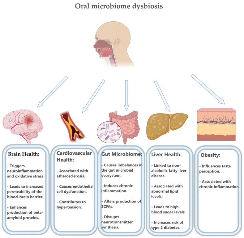Intestinal Insights: The Gut Microbiome's Role in Atherosclerotic Disease: A Narrative Review.