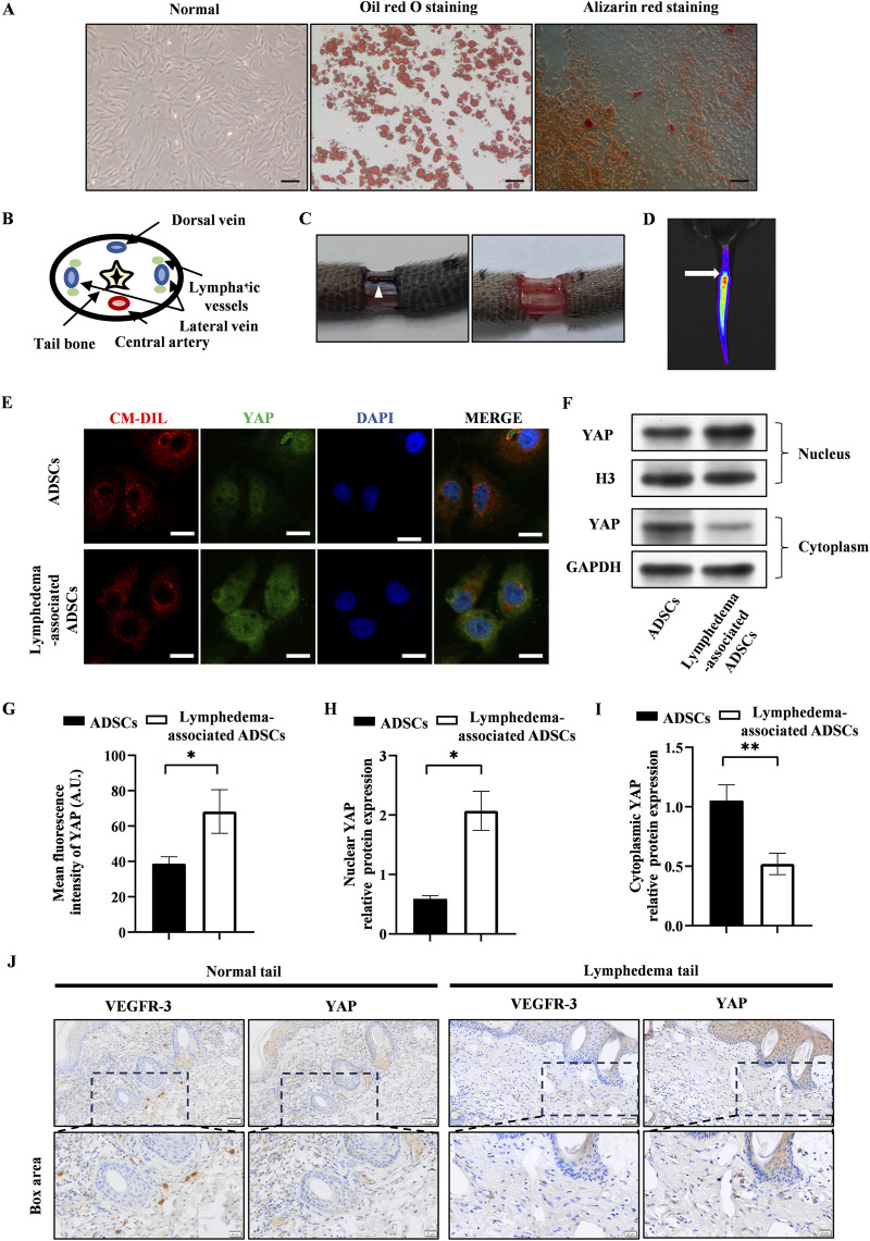 Engineering ADSCs by manipulating YAP for lymphedema treatment in a mouse tail model.
