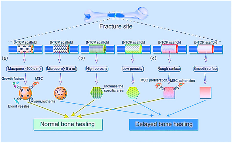 Synthesis and Application of Sustainable Tricalcium Phosphate Based Biomaterials From Agro-Based Materials: A Review.