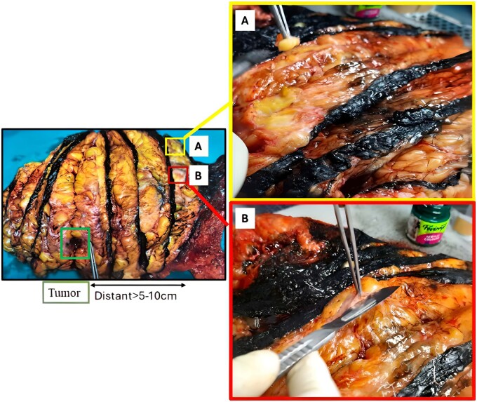Enhancing negative control selection: A comparative analysis of random and targeted sampling techniques for obtaining High-Quality RNA from normal breast tissue.