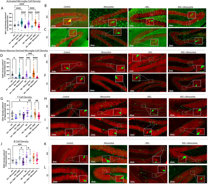 Neuroinflammation underlies the development of social stress induced cognitive deficit in male sickle cell mice.