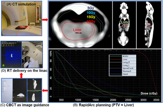 Radiation induced liver injury (RILI) evaluation using longitudinal computed tomography (CT) in image-guided precision murine radiotherapy.