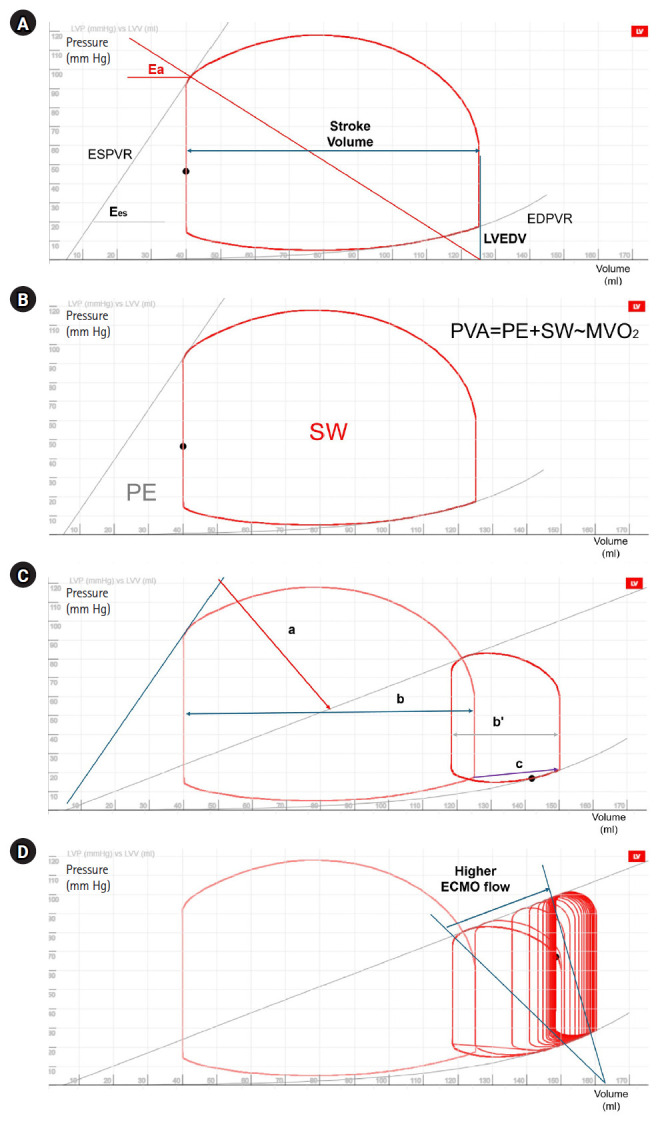 Left ventricle unloading during veno-arterial extracorporeal membrane oxygenation: review with updated evidence.