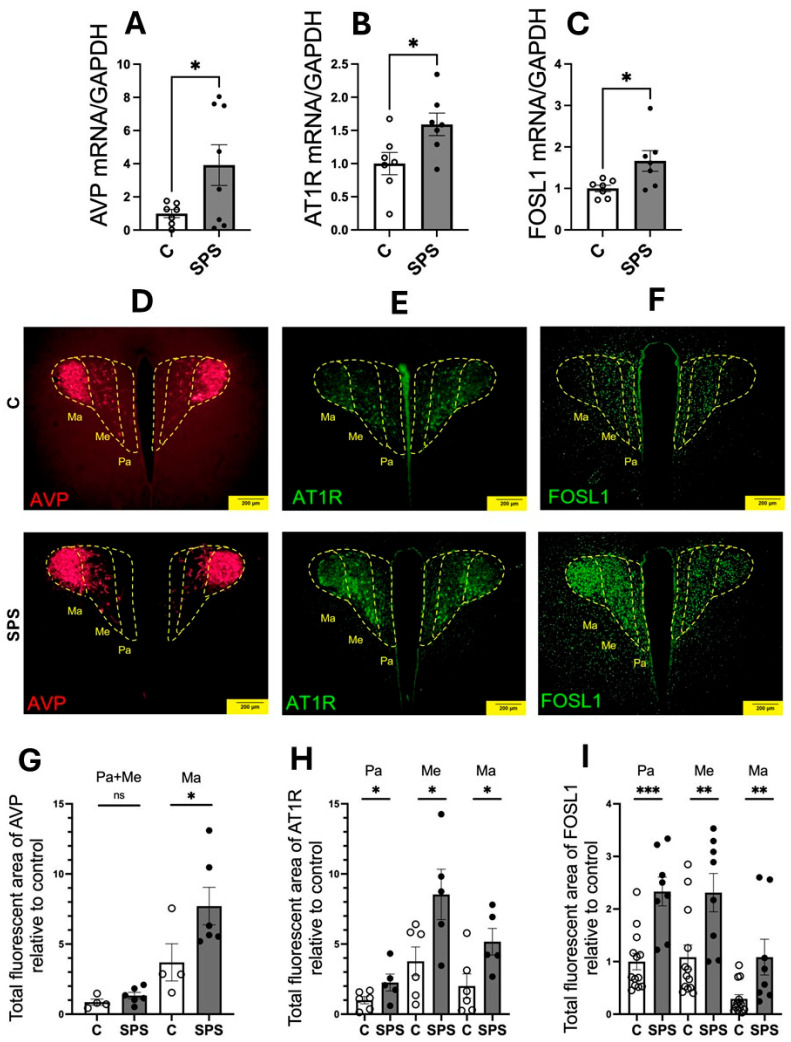 PTSD Increases Risk for Hypertension Development Through PVN Activation and Vascular Dysfunction in Sprague Dawley Rats.