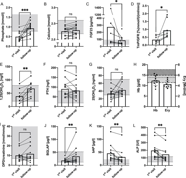 In-depth clinical characterization of intravenous iron infusion-induced hypophosphatemic osteomalacia and its resolution.