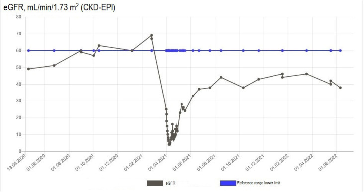 Single zoledronic acid infusion as a cause of acute kidney impairment requiring dialysis in two patients with osteoporosis.
