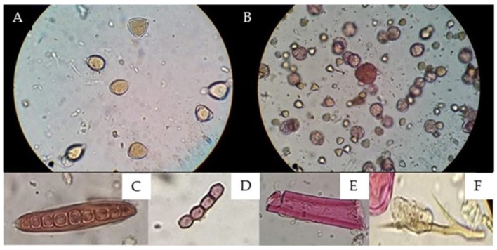 Determination of the Botanical Origin and Physicochemical Properties of a Propolis Sample Through an Integrated Methodology.