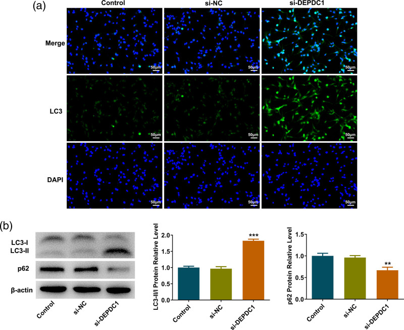 DEPDC1 affects autophagy-dependent glycolysis levels in human osteosarcoma cells by modulating RAS/ERK signaling through TTK.