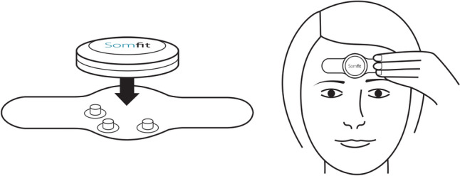 Evaluating Somfit's pulse arterial tonometry for detection of obstructive sleep apnoea.