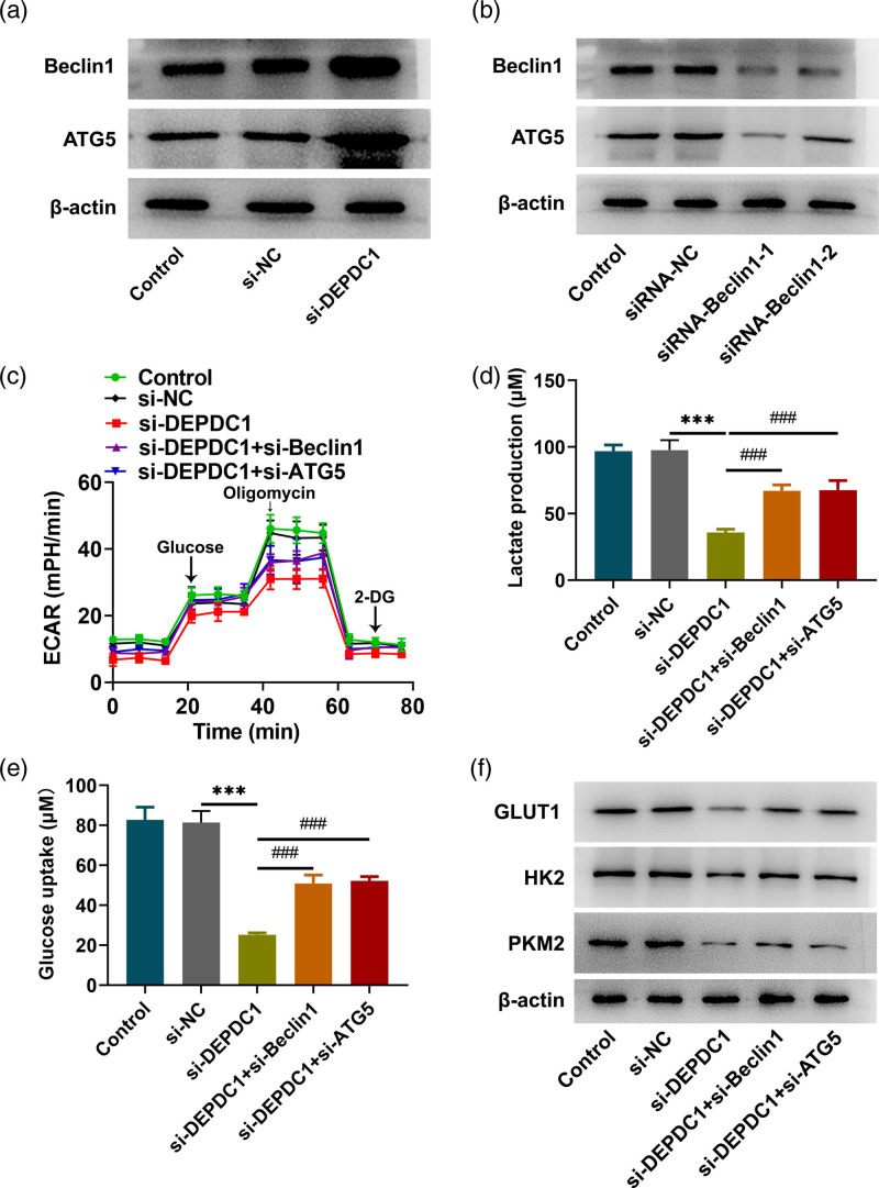 DEPDC1 affects autophagy-dependent glycolysis levels in human osteosarcoma cells by modulating RAS/ERK signaling through TTK.
