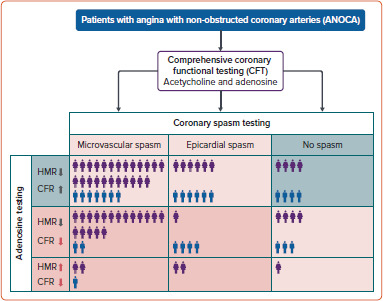 Diagnostic Yield of Comprehensive Coronary Function Testing in Patients with Angina and Unobstructed Coronary Arteries: Endotype Characterisation and Clinical Implications.