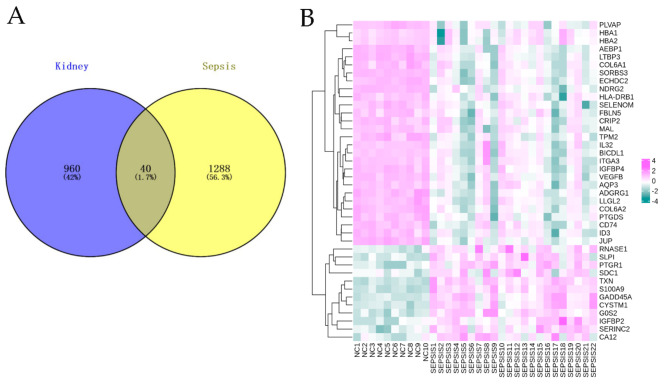 Identification of the key targets for sepsis-associated acute kidney injury by RNA sequencing combined with bioinformatics methods.