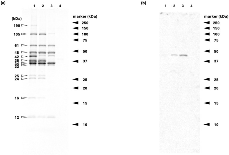 Peptidomic Analysis Reveals Temperature-Dependent Proteolysis in Rainbow Trout (<i>Oncorhynchus mykiss</i>) Meat During Sous-Vide Cooking.