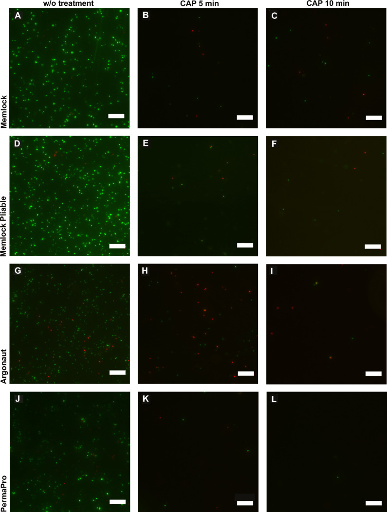 Effectiveness of cold atmospheric plasma in decontaminating enterococcus faecalis colonized collagen and PTFE membranes used in guided bone regeneration: a comparative in vitro investigation.