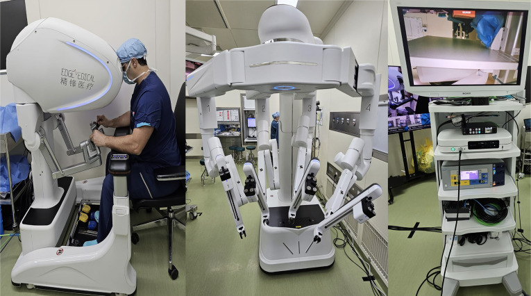 First impressions of Telesurgery robotic-assisted radical prostatectomy using the Edge medical robotic platform.