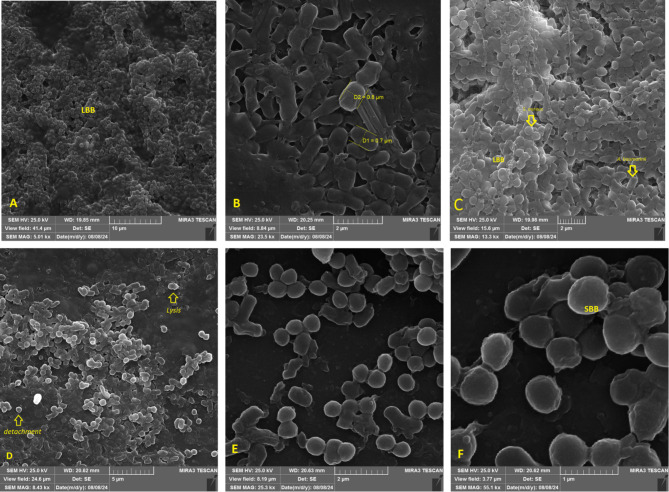 The antimicrobial and antibiofilm effects of gentamicin, imipenem, and fucoidan combinations against dual-species biofilms of Staphylococcus aureus and Acinetobacter baumannii isolated from diabetic foot ulcers.