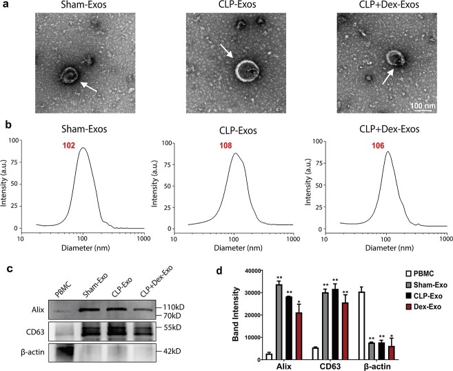 Dexmedetomidine regulates exosomal miR-29b-3p from macrophages and alleviates septic myocardial injury by promoting autophagy in cardiomyocytes via targeting glycogen synthase kinase 3β.