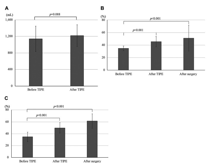 Transileocolic Portal Vein Embolization Increases Remnant Liver Volume After Major Hepatectomy.