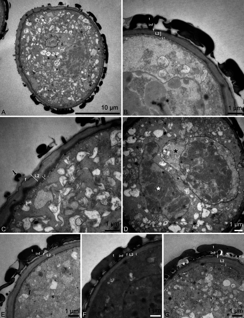 Proximal aperture in Cephalanthera longifolia (L.) Fritsch (Orchidaceae) pollen: a rare germination site for angiosperms.