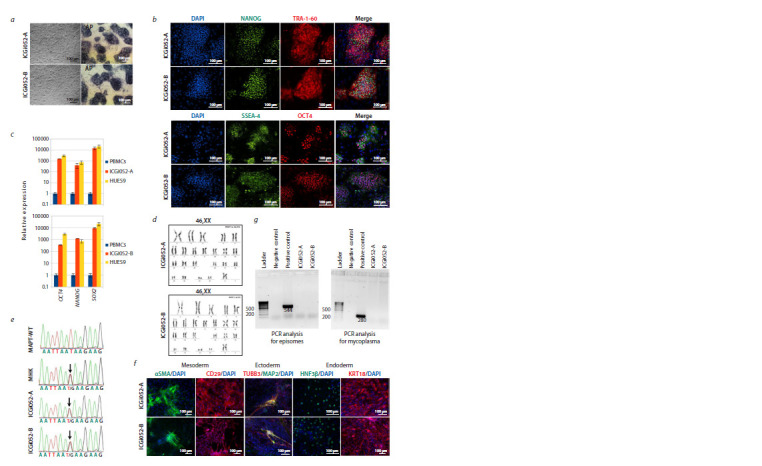 Generation and characterization of two induced pluripotent stem cell lines (ICGi052-A and ICGi052-B) from a patient with frontotemporal dementia with parkinsonism-17 associated with the pathological variant c.2013T>G in the MAPT gene.