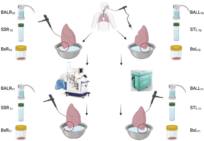 The impact of the EVLP on the lung microbiome and its inflammatory reaction.
