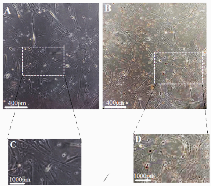 Magnetic graphene oxide increases the biocompatibility and nuclear factor erythroid 2-related factor 2 antioxidant of human cumulus cells: A lab-trial study.