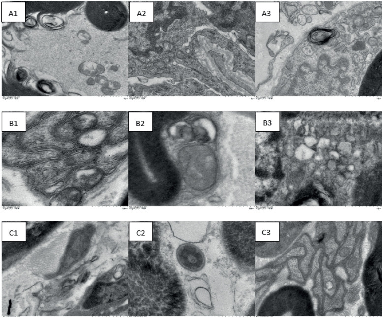Metformin ameliorates peripheral neuropathy in diabetic rats by downregulating autophagy via the AMPK pathway.