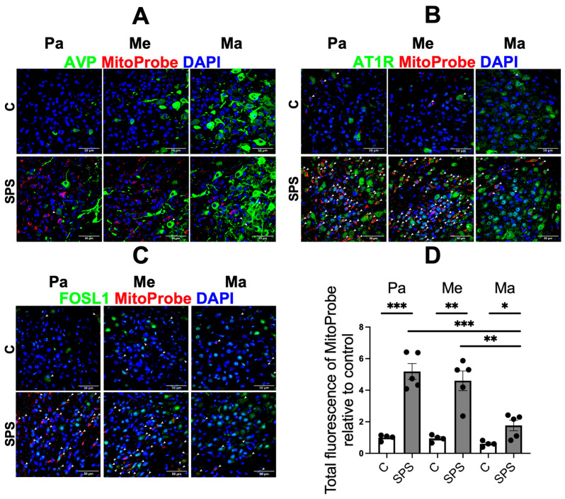 PTSD Increases Risk for Hypertension Development Through PVN Activation and Vascular Dysfunction in Sprague Dawley Rats.