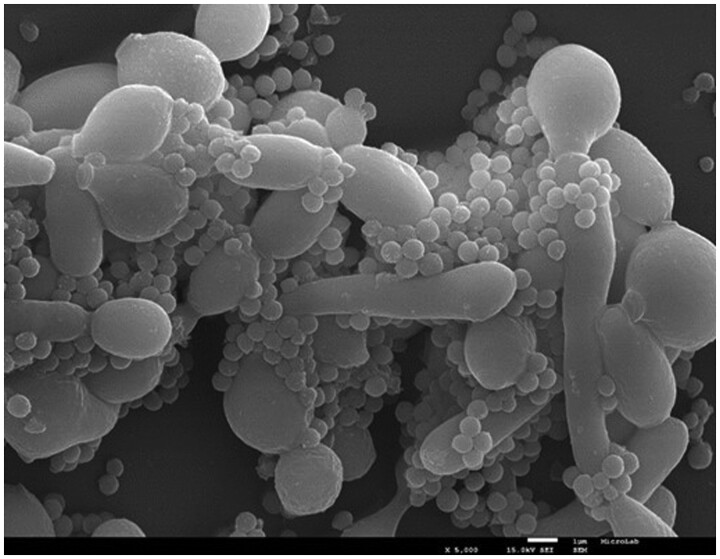 Practical application of PMA-qPCR assay for determination of viable cells of inter-species biofilm of <i>Candida albicans-Staphylococcus aureus</i>.