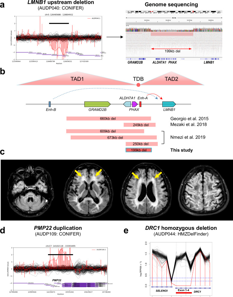 Implementing genomic medicine in clinical practice for adults with undiagnosed rare diseases.