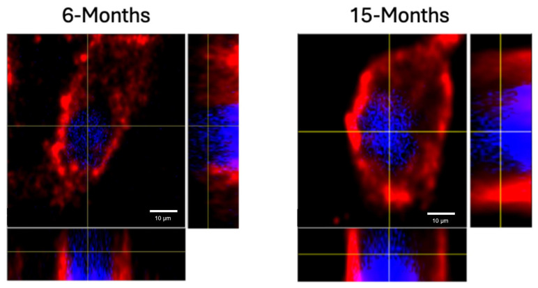 Methyl-Beta-Cyclodextrin Restores Aberrant Bone Morphogenetic Protein 2-Signaling in Bone Marrow Stromal Cells Obtained from Aged C57BL/6 Mice.