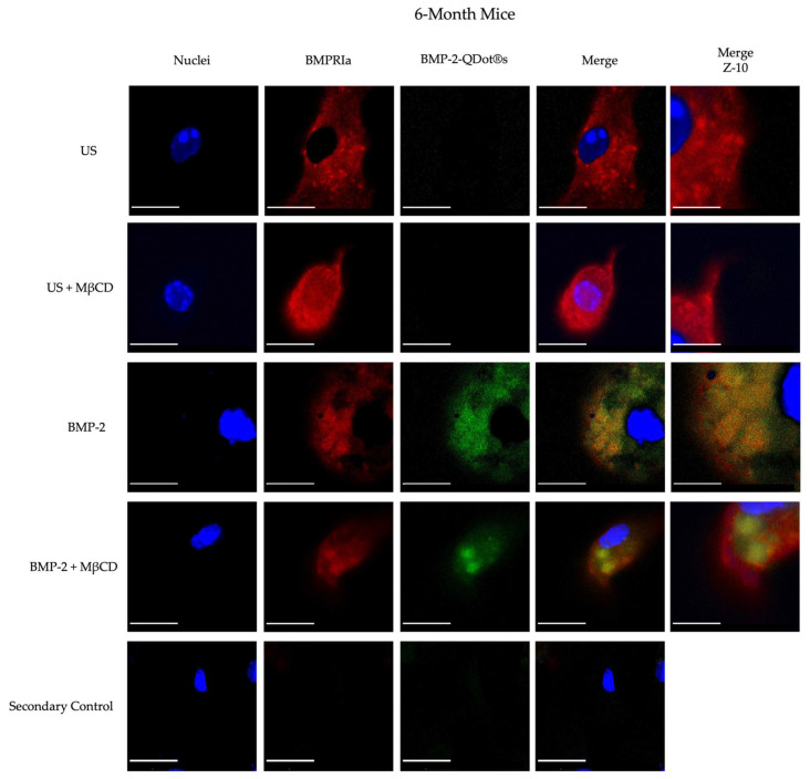 Methyl-Beta-Cyclodextrin Restores Aberrant Bone Morphogenetic Protein 2-Signaling in Bone Marrow Stromal Cells Obtained from Aged C57BL/6 Mice.