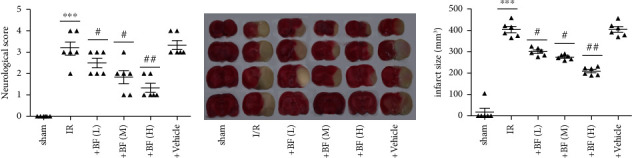 Neuroprotective Effect of Benzyl Ferulate on Ischemia/Reperfusion Injury via Regulating NOX2 and NOX4 in Rats: A Potential Antioxidant for CI/R Injury.