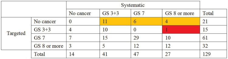 The Role of Freehand Transperineal Prostate Biopsy Under Local Anesthesia Without Antibiotics in Outpatient Settings.