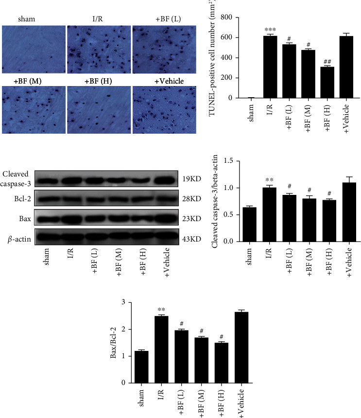 Neuroprotective Effect of Benzyl Ferulate on Ischemia/Reperfusion Injury via Regulating NOX2 and NOX4 in Rats: A Potential Antioxidant for CI/R Injury.
