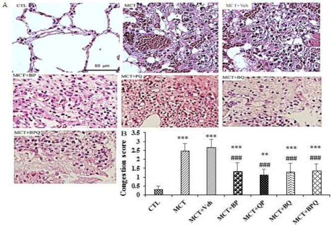Perillyl alcohol, quercetin, and berberine combination therapy ameliorates experimental pulmonary arterial hypertension: Effects on the lung miR-204 expression, remodeling, and inflammatory factors.